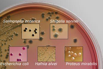 Chromogenic media for Salmonella and Shigella