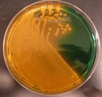 vibrio cholerae serogroup 01