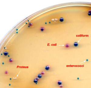 Clarity Agar for UTI Pathogens