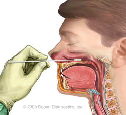 Training Material Facilitates Proper Nasopharyngeal Sample Collection