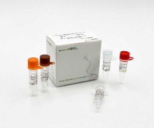 COVID-19 Coronavirus and Influenza A B Virus Real Time PCR Kit