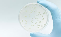 Microbiologics test ready control strains