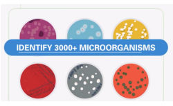 Microbial identification