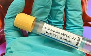 CDC COVID-19 Test Kit is Error-Prone Says Director of US Public Health Lab