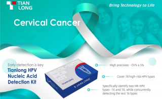 Tianlong Human Papilloma Virus (HPV) PCR Kit Detects 18 High Risk HPV Types