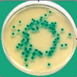 Chromocult Enterobacter sakazakii