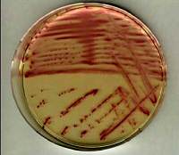 Chromocult Enterococci Agar