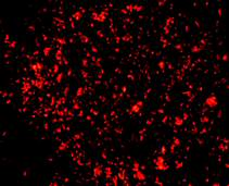 Tb-fluor phenol-free, lung section, rhodamin staining   