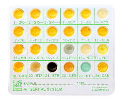 Identification system for urogenital specimens