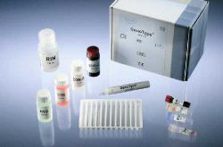 Genotype CDiff test