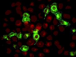 D3 Metapneumovirus