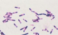 C. difficile