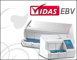 VIDAS EBV assay