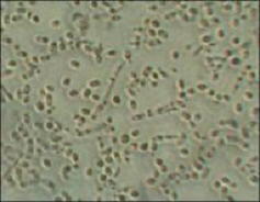 Brettanomyces cells