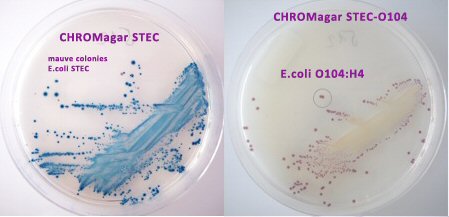 CHROMagar STEC-O104