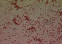 Gram Stain from dry flock swab.