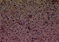 Gram Stain from E-swab with Liquid medium.