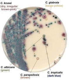 Thermo Scientific Chromogenic Media