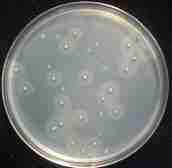 Thermo Scientific Chromogenic Listeria Agar