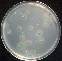 Thermo Scientific Chromogenic Listeria Agar