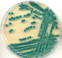 Thermo Scientific Brilliance Bacillus cereus agar