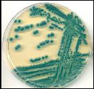 Thermo Scientific Bacillus cereus Agar