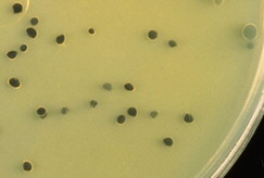 Perfringens Agar OPSP