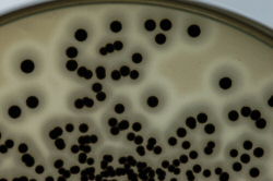 S.aureus colonies on BP medium