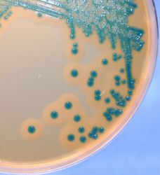 Lab M Harlequin Chromogenic media for Listeria monocytogenes