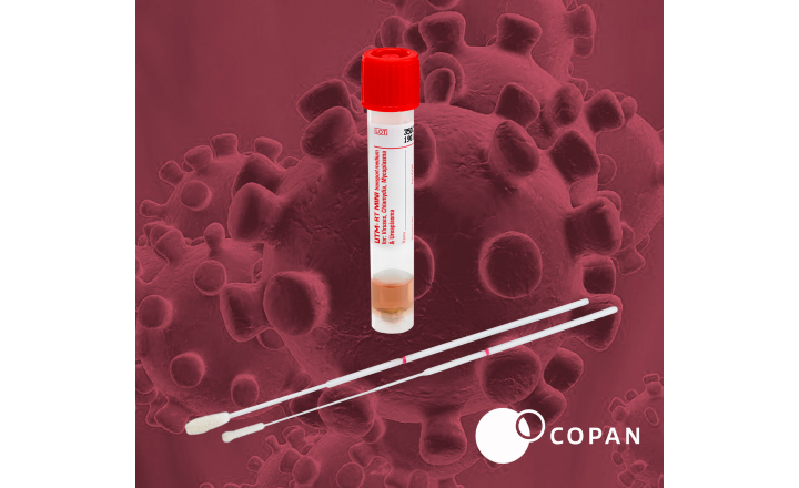 Investigate Novel Coronavirus (2019-nCoV) per CDC Guidelines with COPAN&#39;s FLOQSwab&trade; Kit