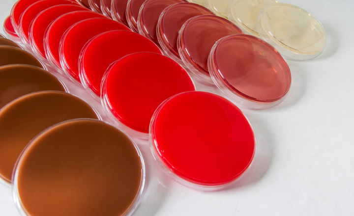 How to Automate the Preparation of Selective Agar Plates&nbsp; &nbsp; &nbsp; &nbsp;