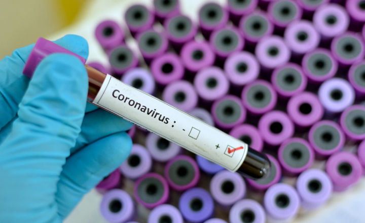 Emergency Special Focus on Covid-19 (2019-nCoV, Coronavirus)