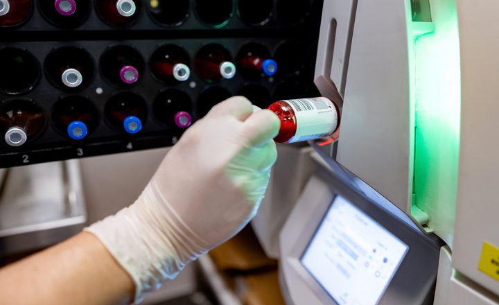 Comparison of Rapid AST Systems like VITEK REVEAL