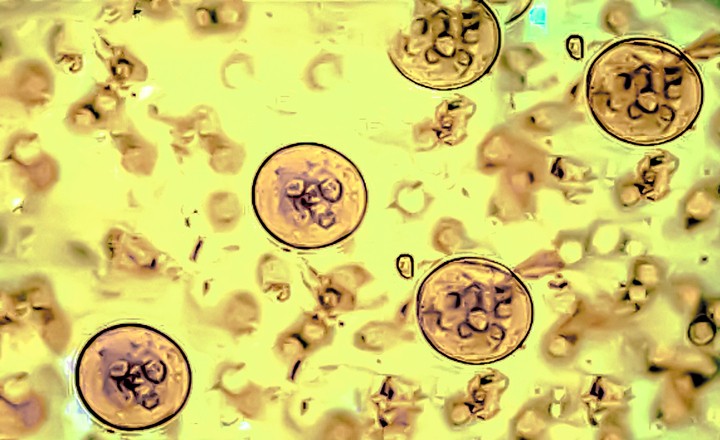 Cryptosporidium oocytes