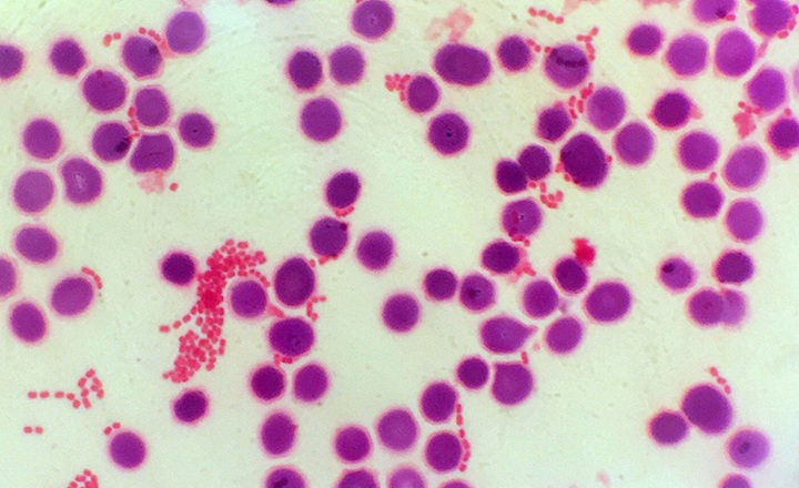 AI-enabled interpretation of Gram stains