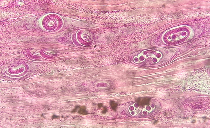 Detection of Meat Borne Parasites