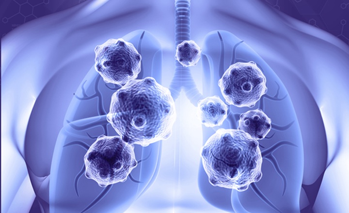 Innate immune functions dictate the severity of cold symptoms