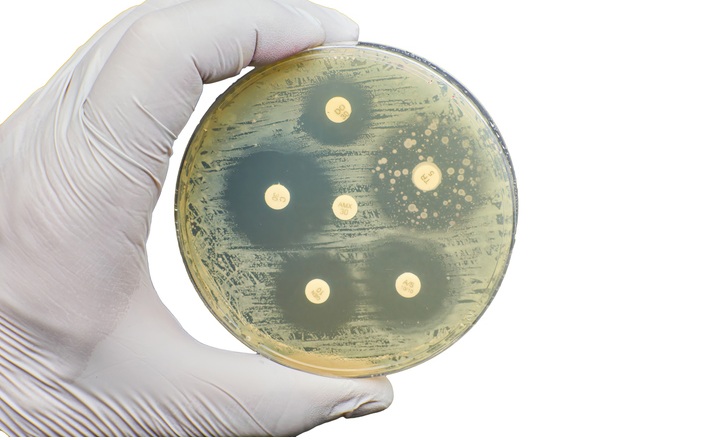 A case of resolving genotype phenotype AST discordance