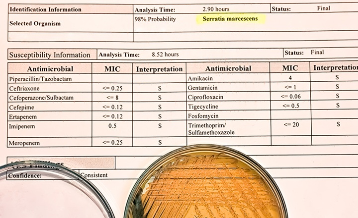 Antimicrobial Susceptibility Testing Challenges of Anaerobes