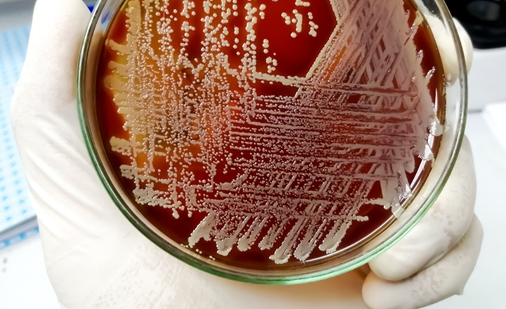 Faster AST reporting equals better outcomes