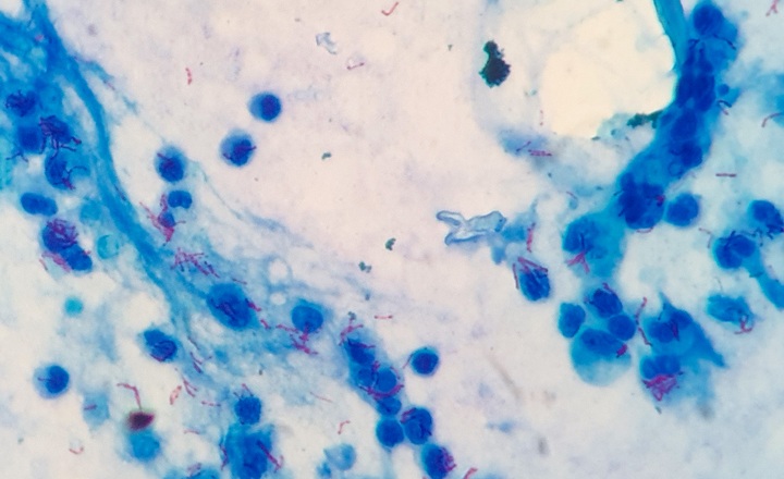 Culture-free ID of Mycobacteria in clinical samples