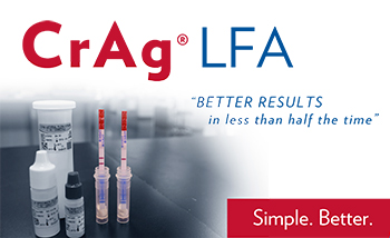 Lateral Flow Cryptococcal Antigen in serum and Cerebrospinal fluid Immuno mycologics