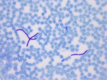 Anthrax Control Positive Slide