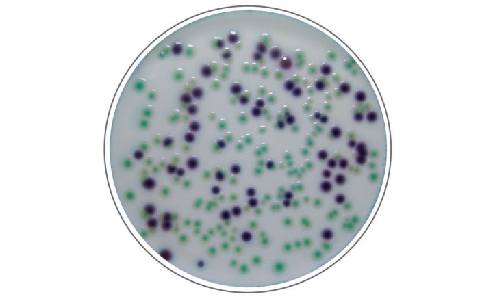 Colonies on an Agar Plate