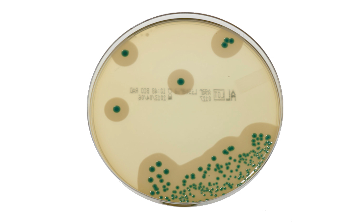 Agar Listeria method