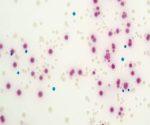 Chromogenic media for detecting Salmonella in foods