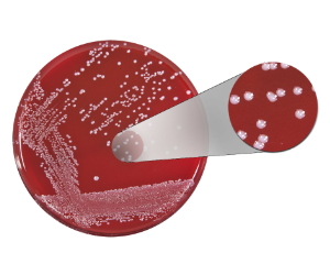 white colonies on an agar plate
