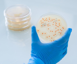 Colonies of b cereus on BACARA chromogenic media