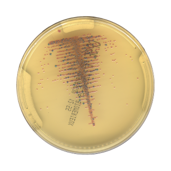 Urine sample results up to 8 Hours Faster bioMerieux