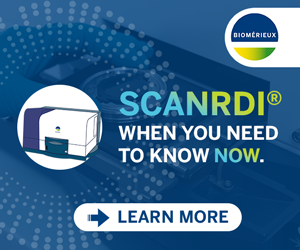 SCANRDI when you need to know now